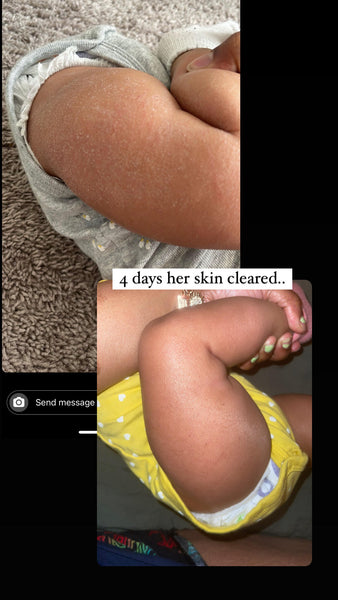 Eucalyptus & Rosemary Bath Melts